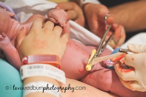 cutting the umbilical cord