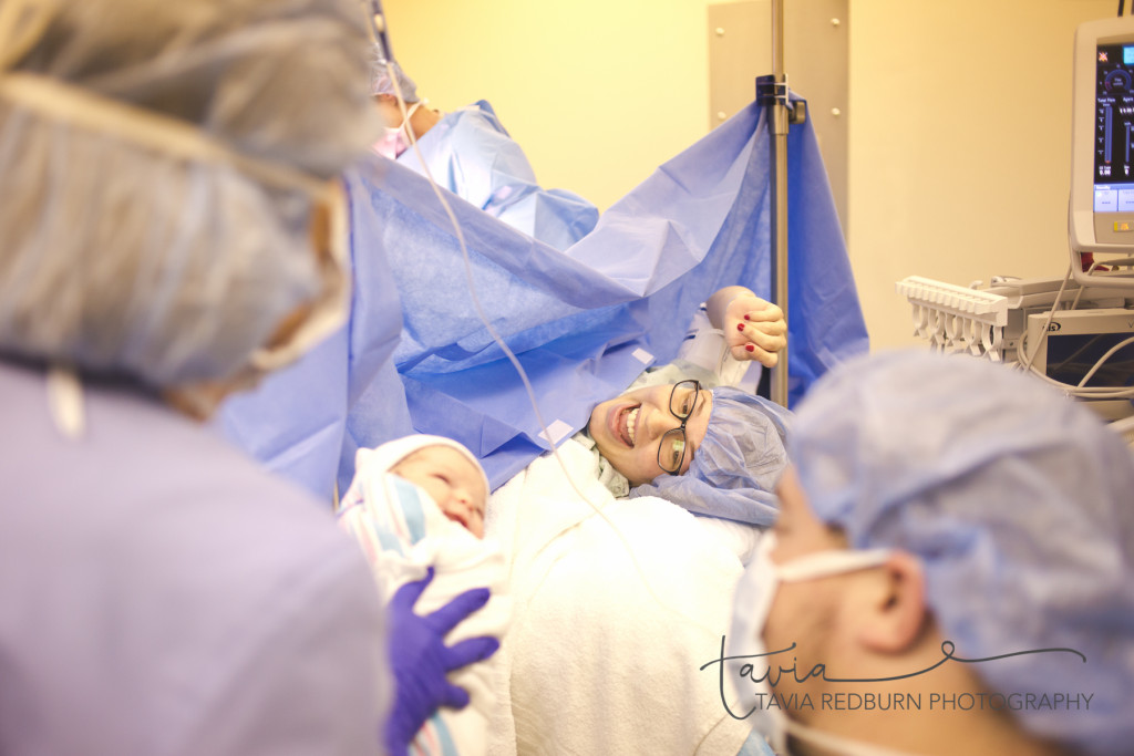 c-section birth photography